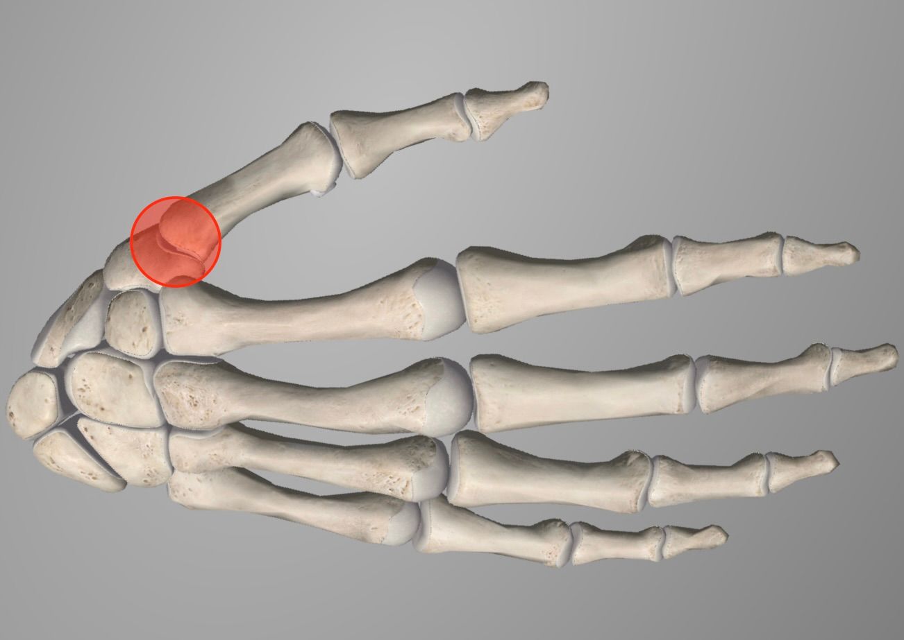 Anatomische weergave van het duimbasisgewricht (CMC1) met het trapezium en het eerste middenhandsbeentje.
